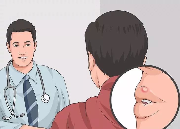 嘴巴上起泡了是怎么回事,嘴巴上起泡了怎么快速消除不用药