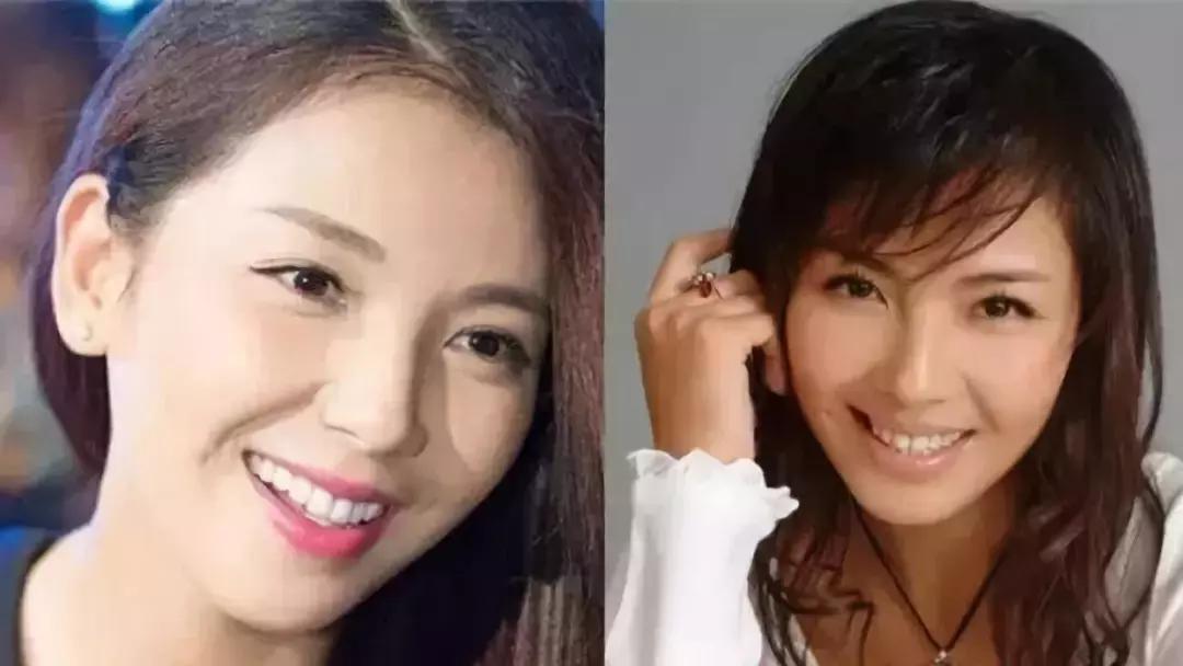 word天！牙齿变白后，人都美了好几度