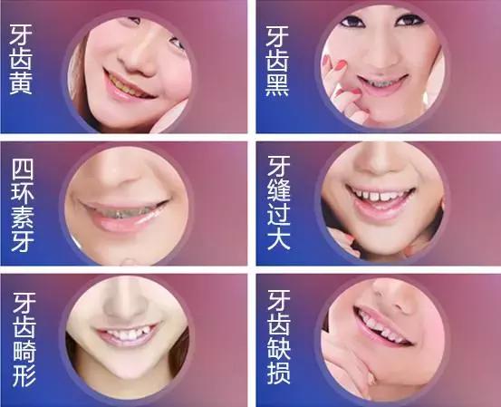 word天！牙齿变白后，人都美了好几度