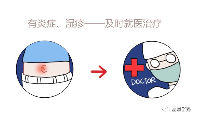 宝宝爱抠妈妈肚脐眼是什么原因,宝宝爱抠肚脐眼抠肿了