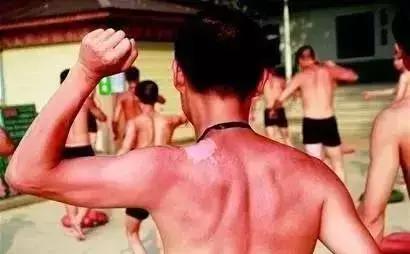 夏季晒伤后的急救方法,自然堂夏季晒伤修复