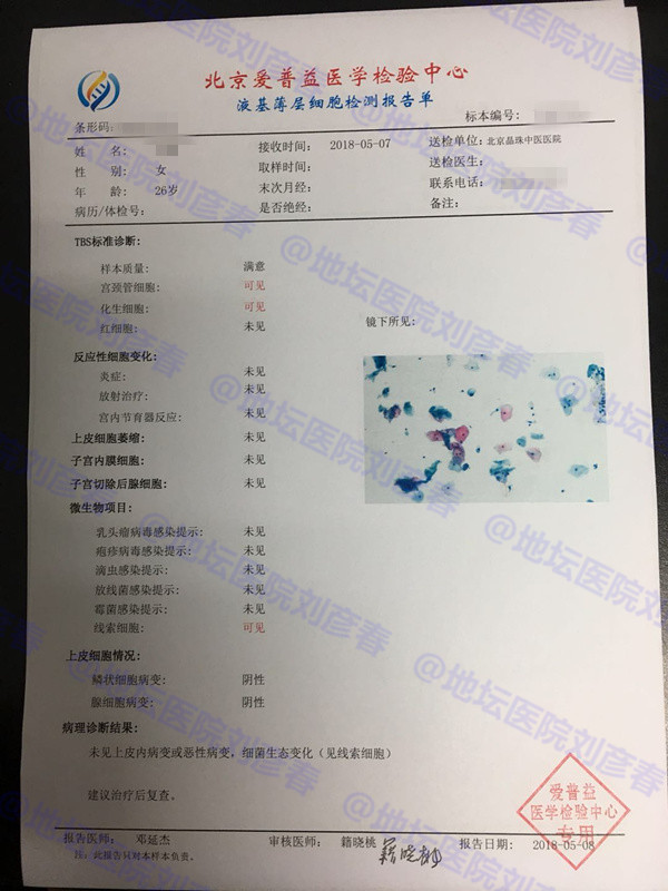 tct显示ascus结果是什么,tct检查ascus如何处理