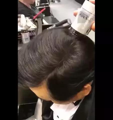 脱发比较严重的90后,脱发严重发际线越来越高