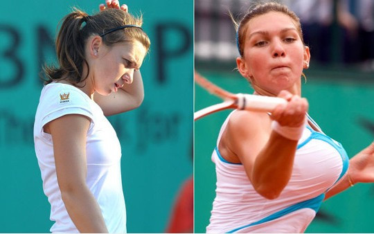 女运动员做缩胸手术,运动员手术缩胸