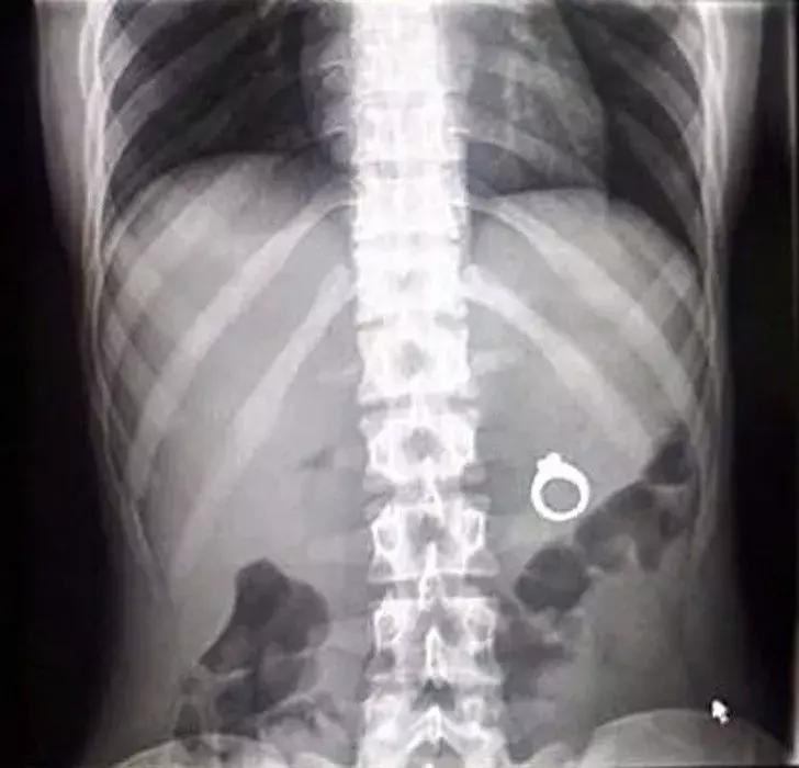 这些奇葩的X光片，看得整个人有点不自在！