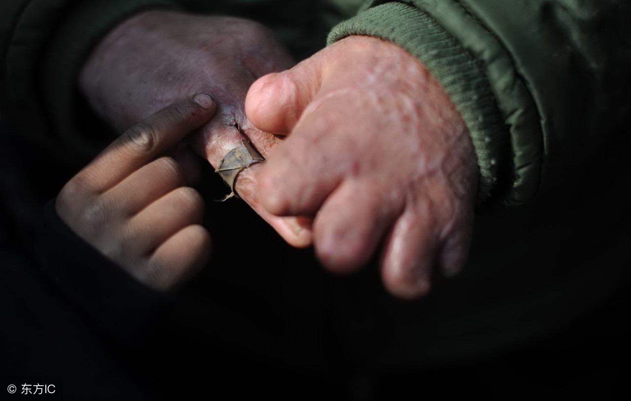 手脱皮吃21金维他还是b族维生素好,孩子手脱皮是缺微量元素吗