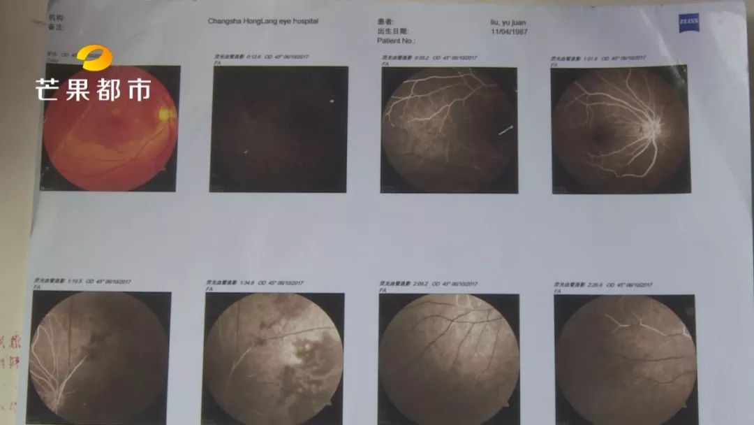 女子花两万整容悄悄变美,十岁女孩整形数次花了100万