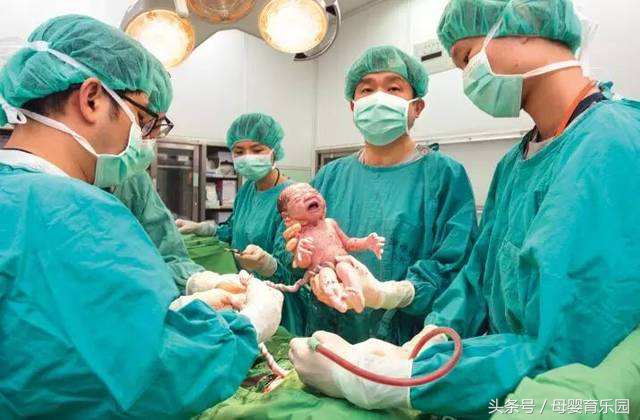 二胎剖宫产需要准备什么,二胎剖腹产孕妈关注事项