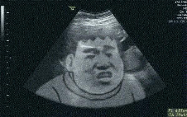 怀孕的搞笑b超图,怀孕了想睡觉表情包