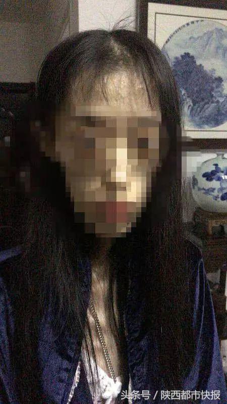 1米67女生48斤,1.65米女孩减肥到49斤后多器官衰竭