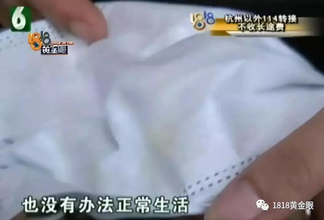 脸上有个小洞一直流脓,脸上有一个毛孔反复化脓结痂