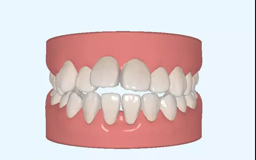 超实用的拔牙小技巧有哪些,拔牙知识图片