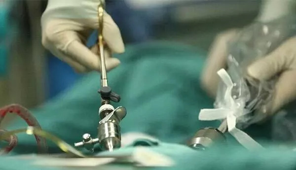 「人医专家说健康」“食”刻“道”来——正确认识食管癌，切勿谈癌色变