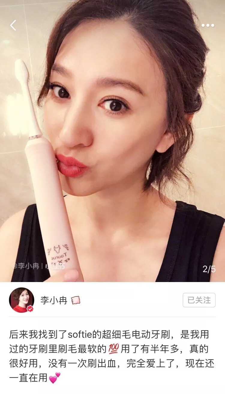 戚薇美白牙齿,戚薇牙齿美白方法