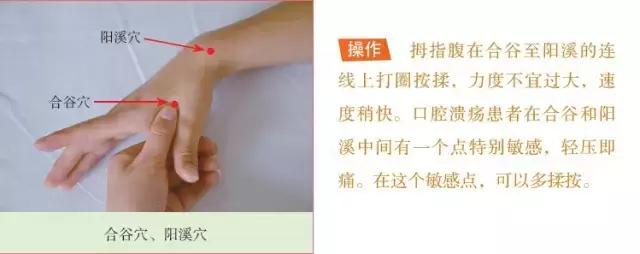 一次性30颗口腔溃疡,一次性溃疡