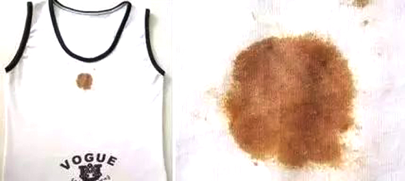 清洗白色衣服顽固污渍的方法,幼儿衣服上的污渍怎么洗