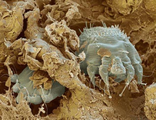 毛囊不会疼吗,毛囊到底有多可怕