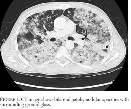 每日咳嗽是什么原因,每日咳痰