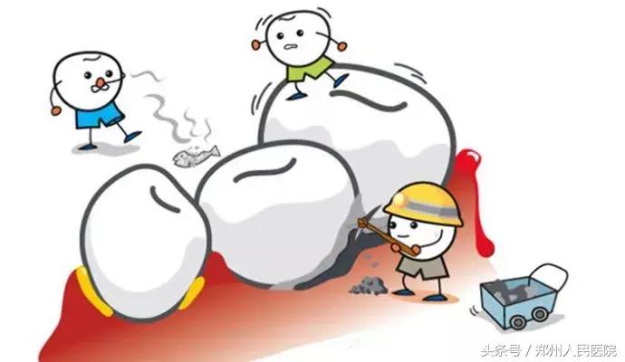 一颗智齿会带来什么危害,一颗智齿惹的祸