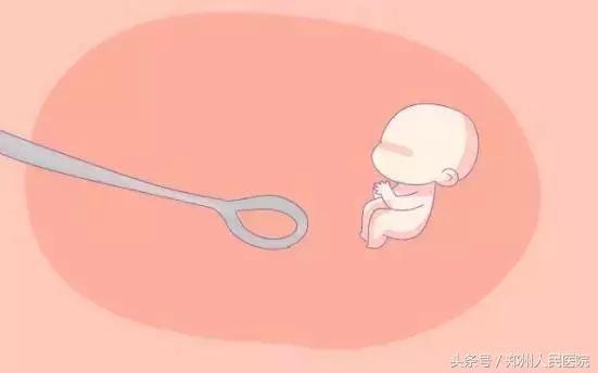 一颗智齿会带来什么危害,一颗智齿惹的祸