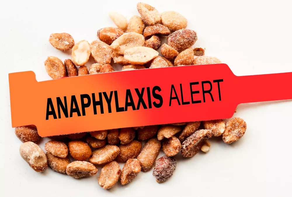 过敏性疾病的发展趋势,过敏性疾病综合治疗方案是什么