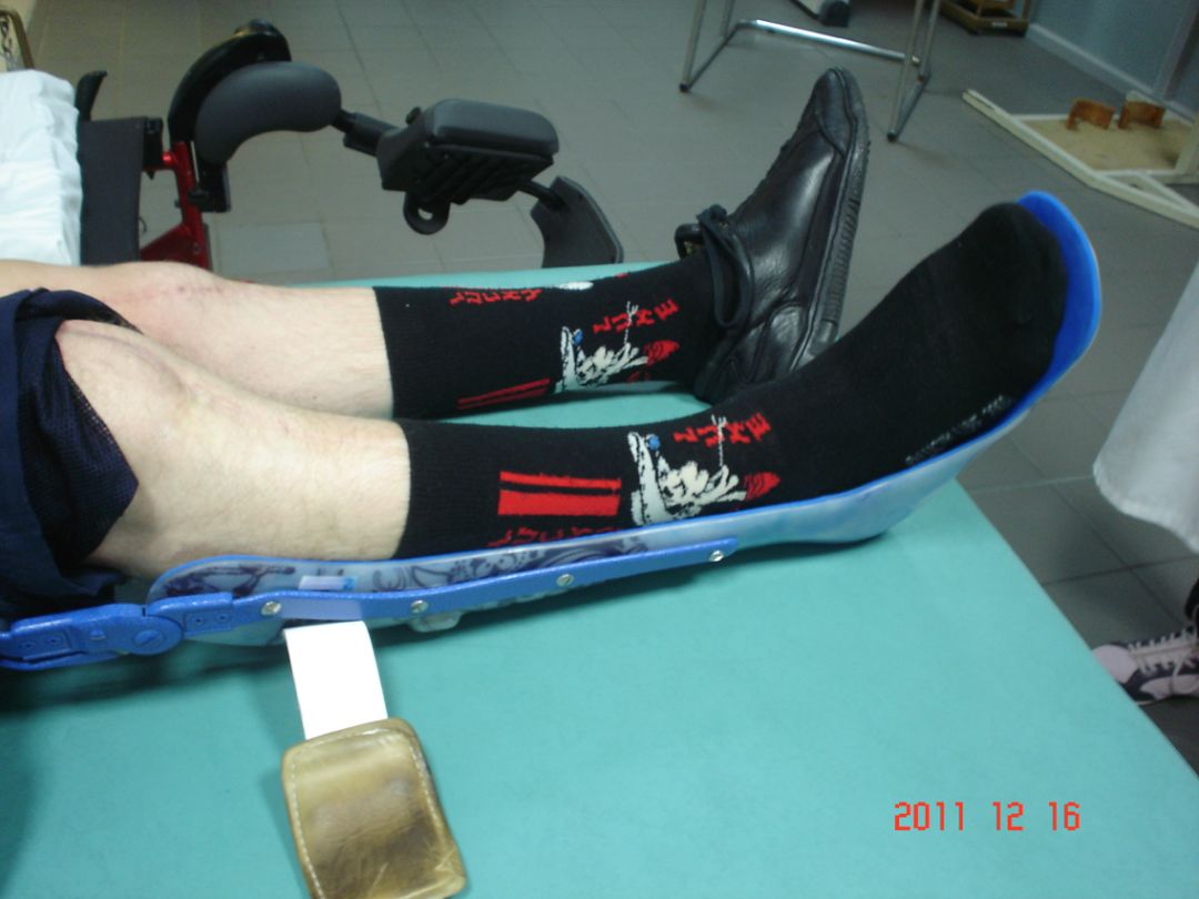 卒中康复训练教学,卒中患者早期康复的时间