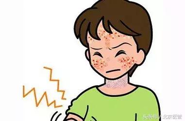 皮肤一晒太阳就过敏是什么原因,一晒太阳脸就过敏发红起皮