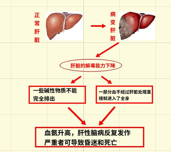 肝昏迷辨证分析,肝昏迷西医治疗