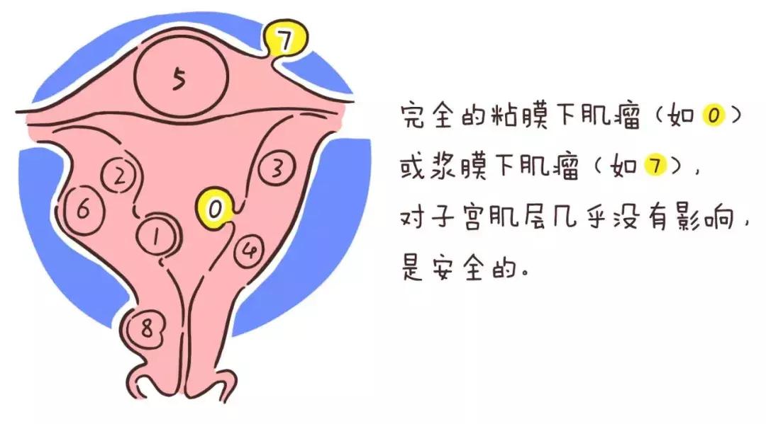 女人生孩子以后容易出现的妇科病,妇科病会影响生宝宝么