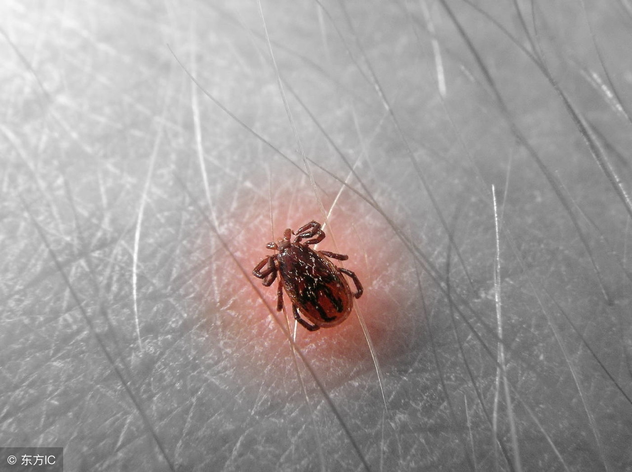 头上很多螨虫卵,头上螨虫多起疙瘩