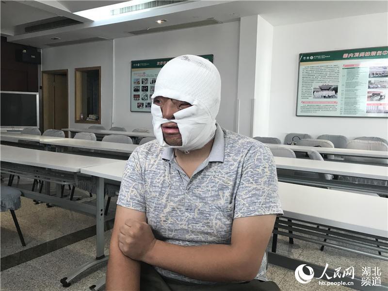 琚噸搴︾儳浼ょ殑灏忎紮,琚儳浼ゅ悗鐨勫皬浼欏瓙