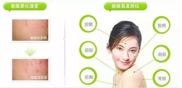 孕期护肤清单分享怀孕也要皮肤好,你以为孕期护肤很简单其实你错了