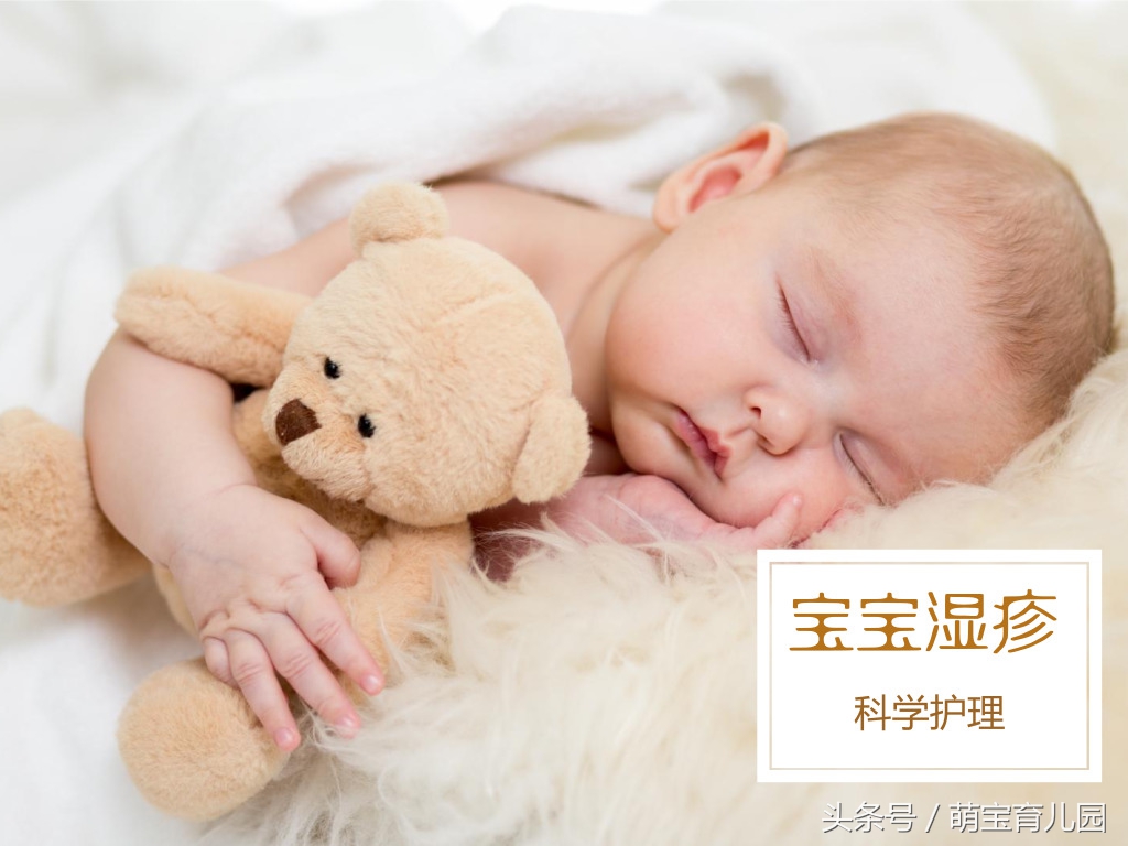 宝宝湿疹要关注哪些事项,宝宝湿疹的关注事项