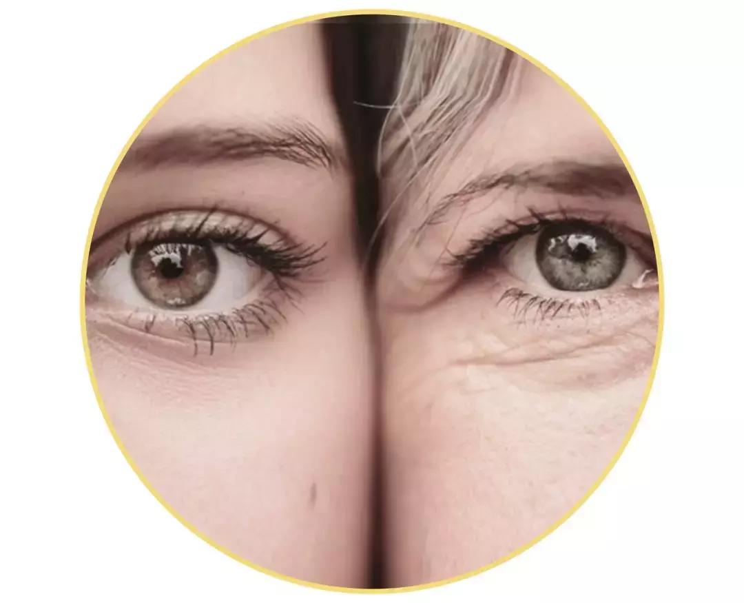 黑眼圈没办法吗,黑眼圈怎么不靠化妆消除