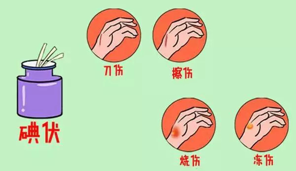 紫药水擦过的伤口,紫药水涂伤口关注事项