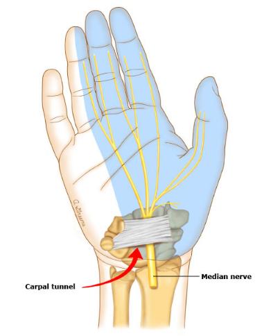 颈椎病手痛手麻最好的解决方法,20岁进厂打工的感受