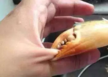 杭州大妈手指红肿、体温38！吃蟹季，这些事儿你需要知道！