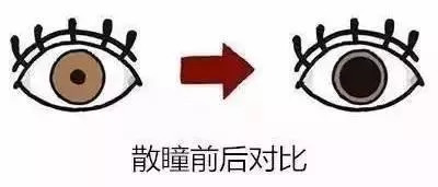 阿托品能治疗多少度近视,阿托品近视防控的关注事项