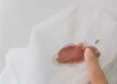 衣服不管染上什么只需一招,衣服染到污渍怎么洗掉