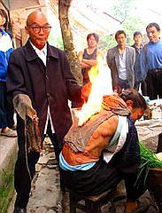 火疗爱好者，必须关注的问题