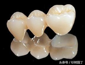 美牙仪真的有用吗骗人的吗,美牙仪是有线的好还是无线的好