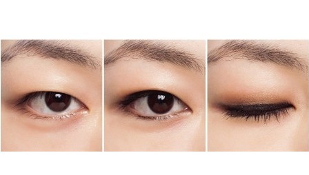 眼睛天生小怎么变大手术,眼睛天生小怎么办