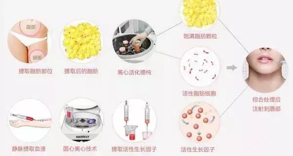 周迅嘴巴嘟嘟,周迅的嘴巴本来就是嘟的吗