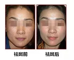 别再花冤枉钱买黑科技软件了,别再花冤枉钱了护肤品