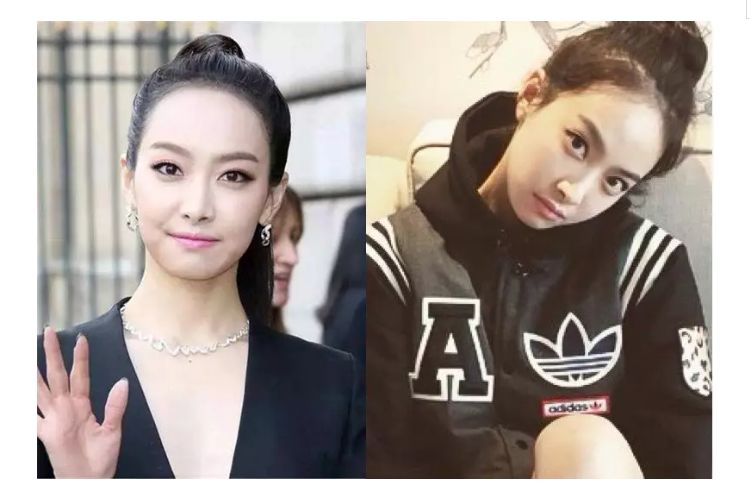男人发际线后移怎么拯救,如何拯救发际线后移