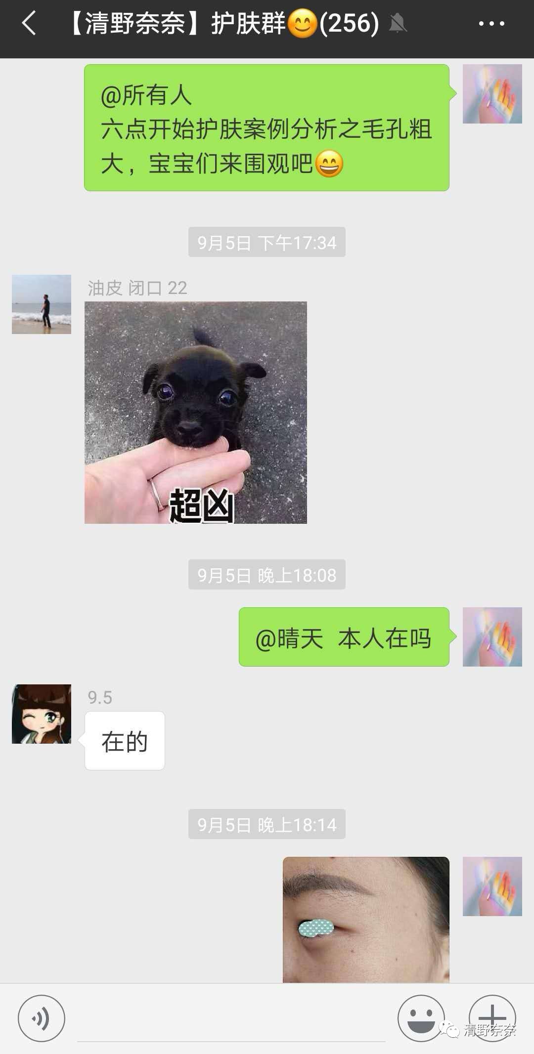 关了美颜也拒做海绵宝宝收毛孔大招vs针清后如何快速摆脱痘印？