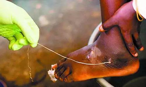 吃活物有寄生虫,吃活的虫子身体里有寄生虫