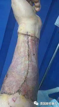 一出生就没了12个器官,一出生就没有肚脐