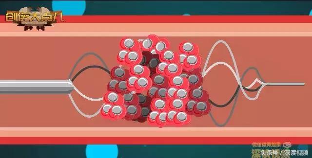 紧急救援脑梗,脑梗溶栓护理科普动画通俗易懂