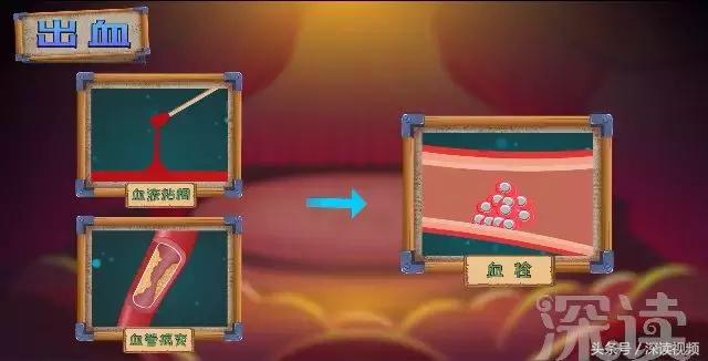 紧急救援脑梗,脑梗溶栓护理科普动画通俗易懂